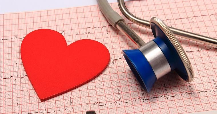 Stetoskop i plastikowe serce na tle wydruku EKG