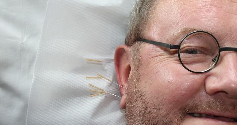 Mężczyzna poddaje się akupunkturze ucha
