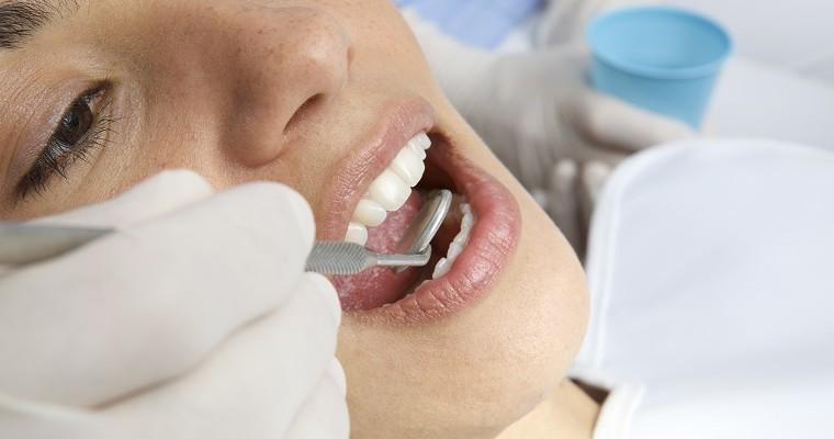 Kobieta podczas wizyty u dentysty 