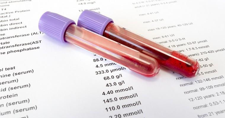 Próbki krwi leżą na wynikach badań