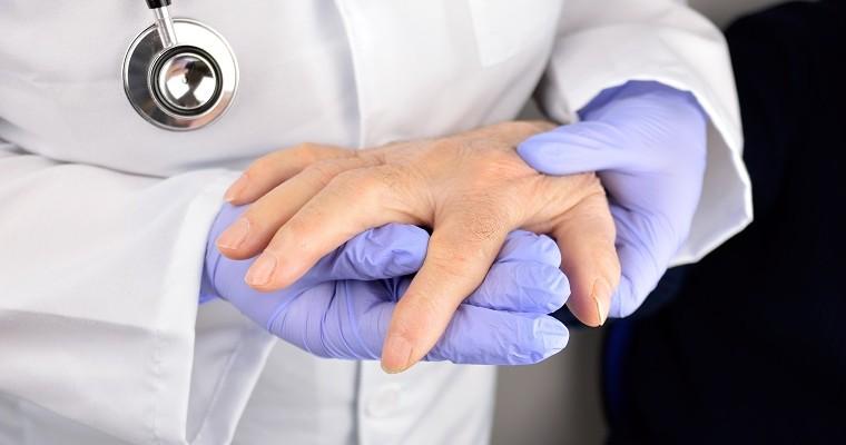 Lekarz ogląda dłoń pacjenta z reumatoidalnym zapaleniem stawów. 