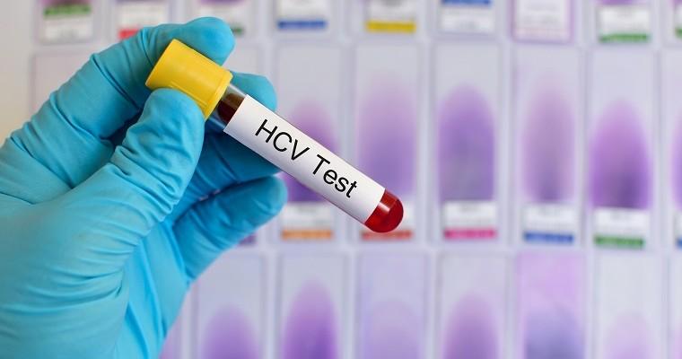 test na HCV 