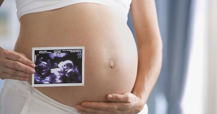 kobieta w ciąży trzyma w ręku zdjęcie usg