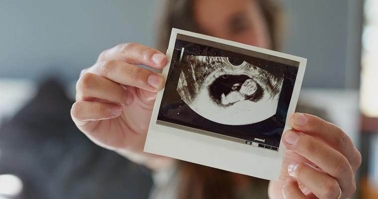 kobieta trzyma w dłonie zdjęcie USG płodu dziecka. 