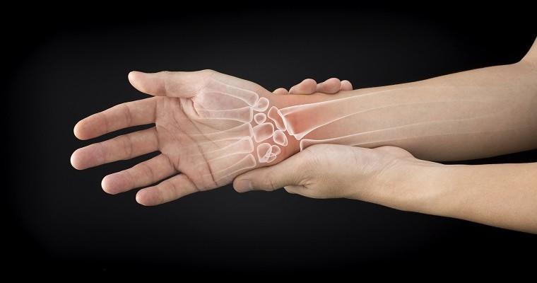 Ludzka dłoń z uszkodzeniami kości nadgarstka