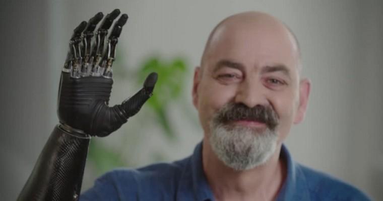 Fot. Kadr z programu 36,6 - mężczyzna z bioniczną ręką. 
