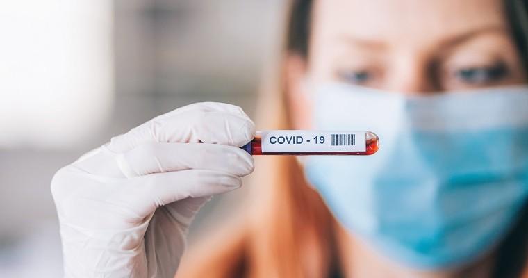 próbka krwi z COVID-19 