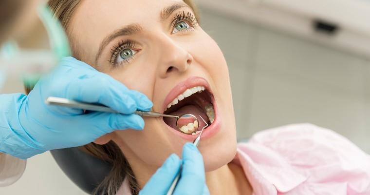 Kobieta podczas wizyty kontrolnej u dentysty 