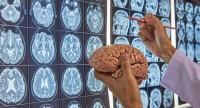 Operacja mózgu – przebieg najpowszechniejszych zabiegów i czas ich trwania
