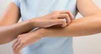 Wysypka na ramionach u dzieci i dorosłych – możliwe przyczyny i sposoby leczenia