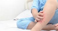 Wysypka na nogach u dziecka – kiedy należy się niepokoić na jej widok?