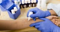 Testy alergiczne z krwi ogólne i specyficzne:
potwierdzanie alergii i wykrywanie alergenów