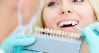 Wybielanie zębów – czynniki, sposoby, zalecenia i przeciwwskazania