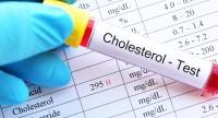 Czy niski poziom cholesterolu jest niebezpieczny?
Sprawdź!