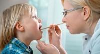 Kandydoza jamy ustnej – przyczyny i objawy.
Jak ją leczyć?