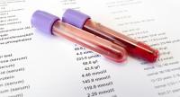 Biochemia krwi (badanie biochemiczne) – jak interpretować wyniki? 
