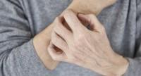 Co wywołuje uczulenie na rękach?
Objawy i łagodzenie alergii na dłoniach