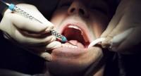 Torbiel zęba – objawy.
Jak leczyć torbiel w jamie ustnej? 