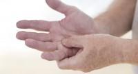 Pękająca skóra na dłoniach.
Jak zapobiegać i jak pielęgnować?