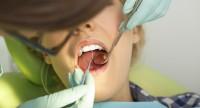 Zęby trzonowe u dziecka, w uzębieniu stałym.
Objawy wyrzynania się zębów trzonowych
