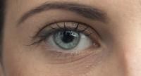 Czerwone oczy (zespół czerwonego oka) – przyczyny, domowe sposoby, leczenie