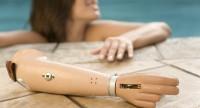 Proteza ręki standardowa i bioniczna – zastosowanie i koszty