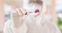Szybkie testy na obecność koronawirusa dają przekłamane wyniki?