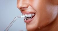 Irygator do zębów – niezastąpiona specjalistyczna pomoc w higienie jamy ustnej