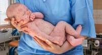 Opryszczka u niemowląt – jak nie zarazić niemowlaka opryszczką?