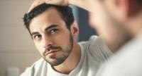 Sposoby na zakola – preparaty, szampony, fryzury, czyli specjalistyczne i domowe metody leczenia łysienia u mężczyzn