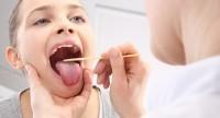 Grzybica jamy ustnej – objawy, rodzaje, przyczyny i leczenie