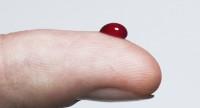 Hematofobia – lęk przed krwią.
Jak się objawia i jak leczyć to schorzenie?