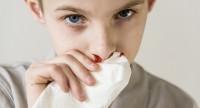 Krwotok z nosa – przyczyny i skuteczne sposoby tamowania krwawienia