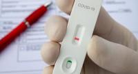 Od 15 marca będzie można kupić domowy test na koronawirusa.
Czy warto go nabyć?