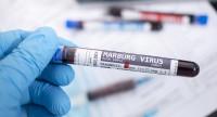 Wirus Marburg.
Czy grozi nam kolejna pandemia? 