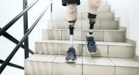 Proteza nogi standardowa i bioniczna – rodzaje i koszty
