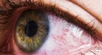 Nowotwór oka u dorosłych i dzieci – objawy, przyczyny i leczenie