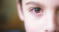 Czerwone oczy u dziecka - jakie są tego przyczyny?