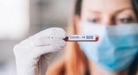 NFZ zapłaci za testu w kierunku koronawirusa dla lekarzy