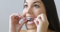 Na czym polega wybielanie zębów metodą nakładkową?
Efekty i czas trwania zabiegów