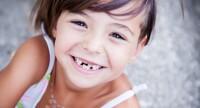 Kiedy wypadają zęby mleczne?
Jak zadbać o zdrowy uśmiech dziecka?