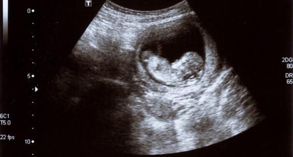 16 tydzień ciąży – jak wygląda dziecko na USG? Jakie objawy może odczuwać matka?