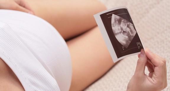 3 miesiąc ciąży – jakie daje objawy? Czy widać już powiększony brzuch?