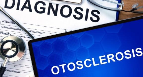 Otoskleroza – jakie ma objawy, jak ją leczyć?