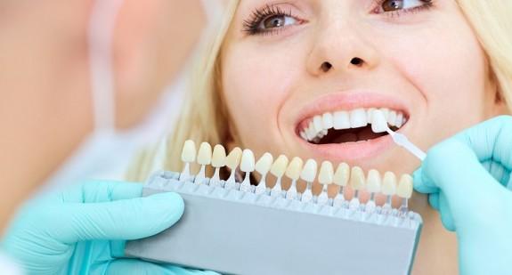 Wybielanie zębów – czynniki, sposoby, zalecenia i przeciwwskazania