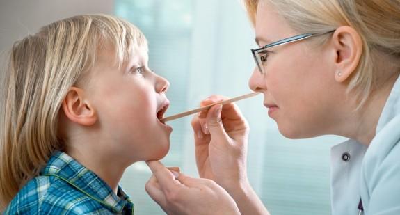 Kandydoza jamy ustnej – przyczyny i objawy. Jak ją leczyć?