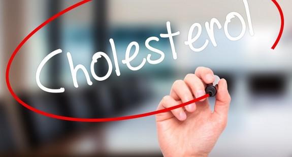 Jaka jest górną granica cholesterolu? Kto i kiedy przeprowadził badania i ustalił taką granicę?
