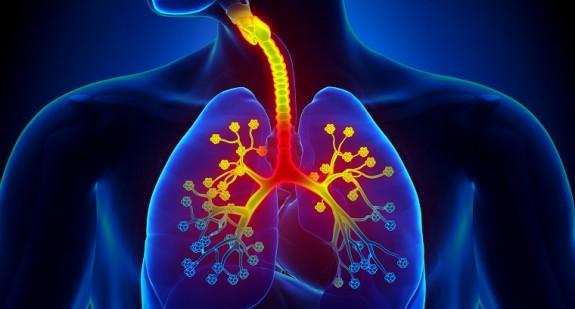 Choroby płuc – jakie objawy występują najczęściej? Przyczyny i rodzaje