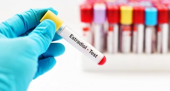 Estradiol – normy hormonu, badanie, co oznacza niski poziom, a co wysoki? 