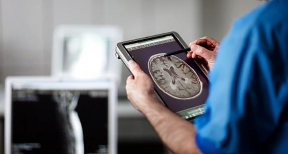 Naczyniak mózgu – jak powstaje i jak się go leczy?